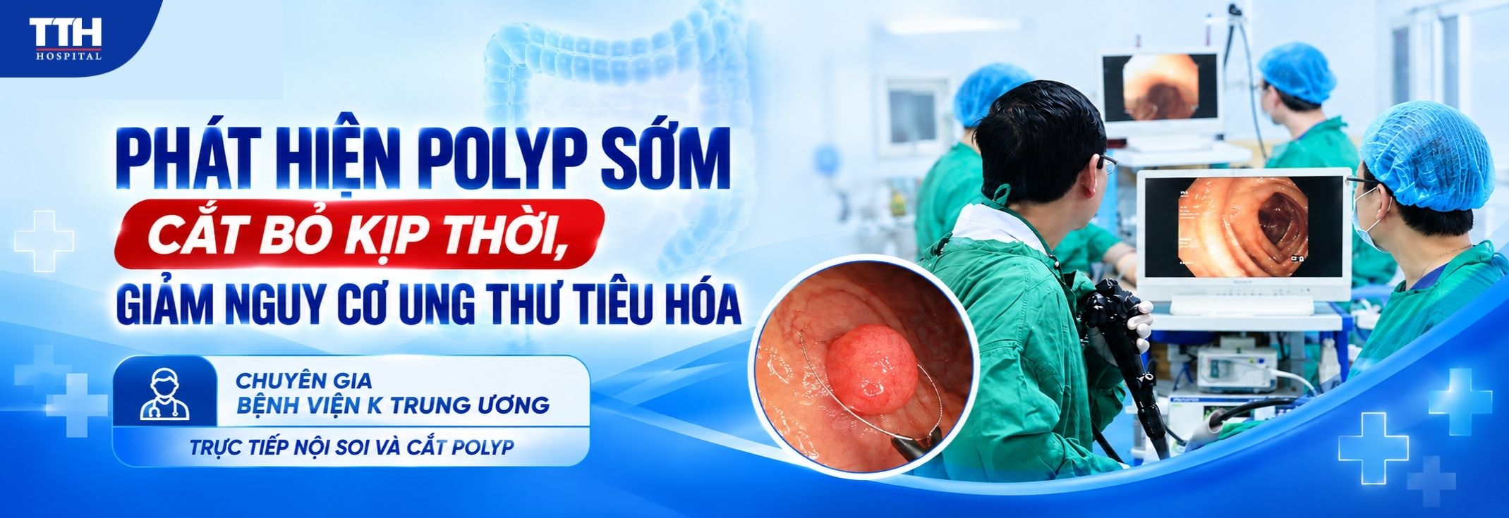 PHÁT HIỆN POLYP SỚM – CẮT BỎ KỊP THỜI, GIẢM NGUY CƠ UNG THƯ TIÊU HÓA CÙNG CHUYÊN GIA